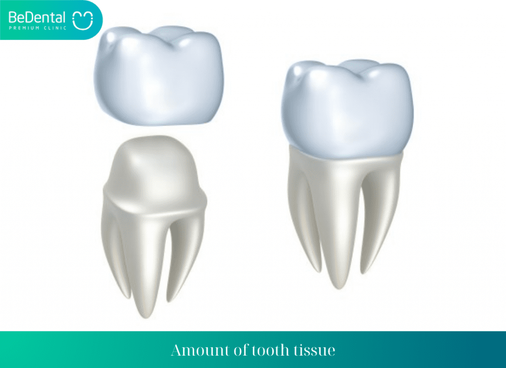 Amount of tooth tissue