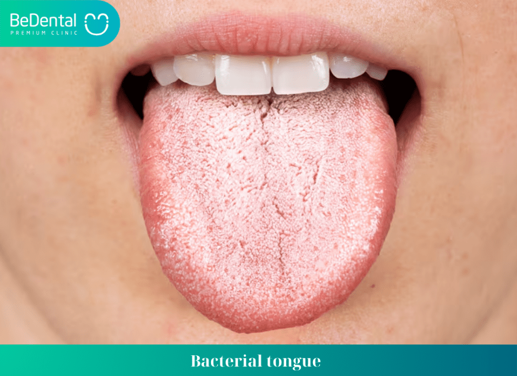 Bacterial tongue