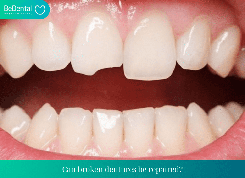 Can a Broken Denture Be Repaired