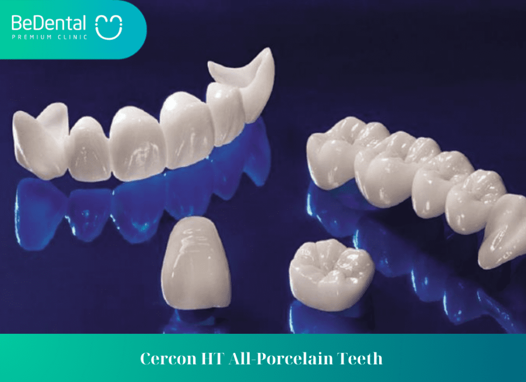 Cercon HT All Porcelain Teeth