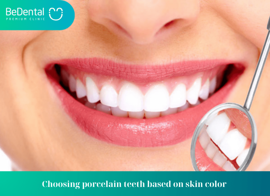 Choosing porcelain teeth based on skin color