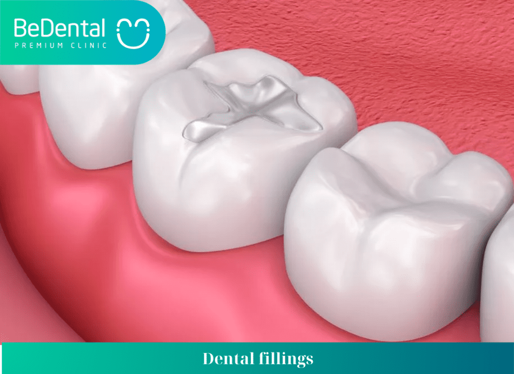 Dental fillings