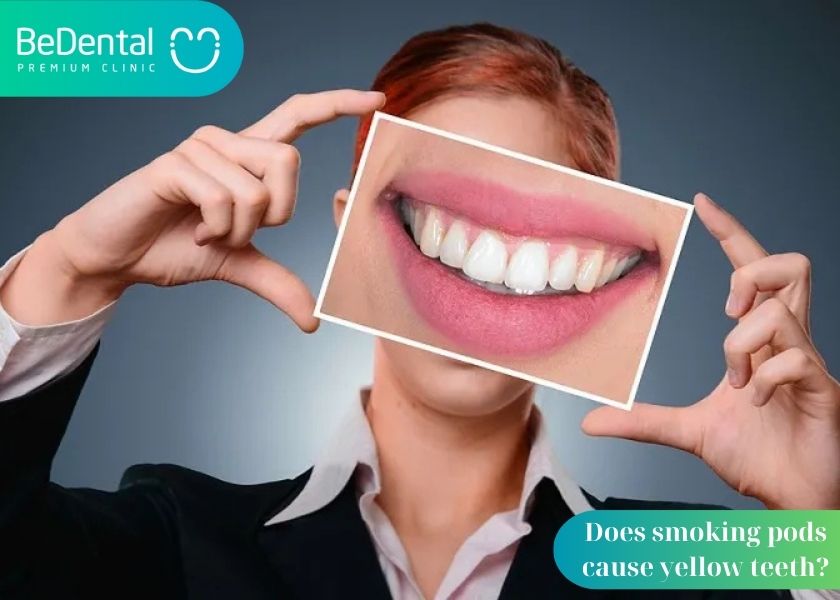 Does smoking pods cause yellow teeth?