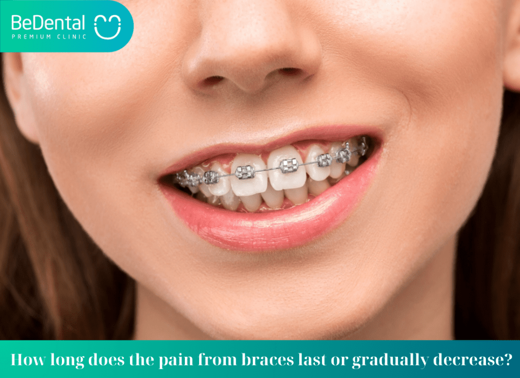 How long does the pain from braces last or gradually decrease