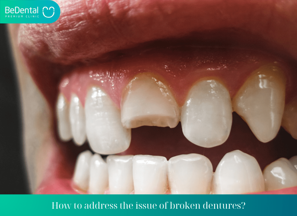 How to address the issue of broken dentures