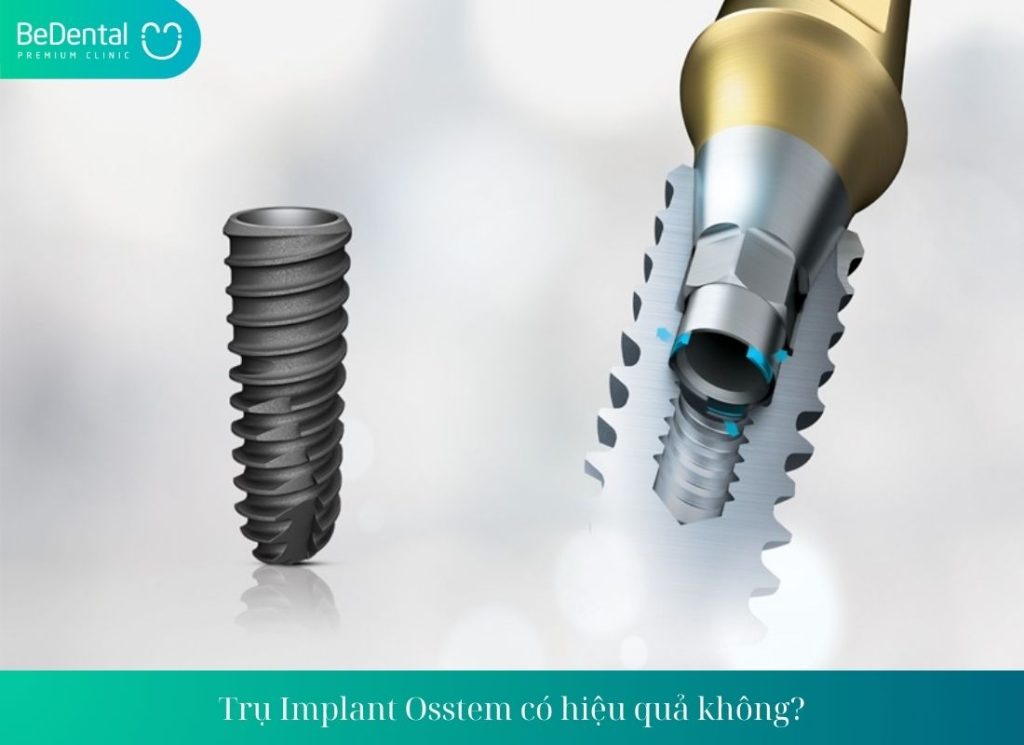 Trụ Implant Osstem có hiệu quả không?