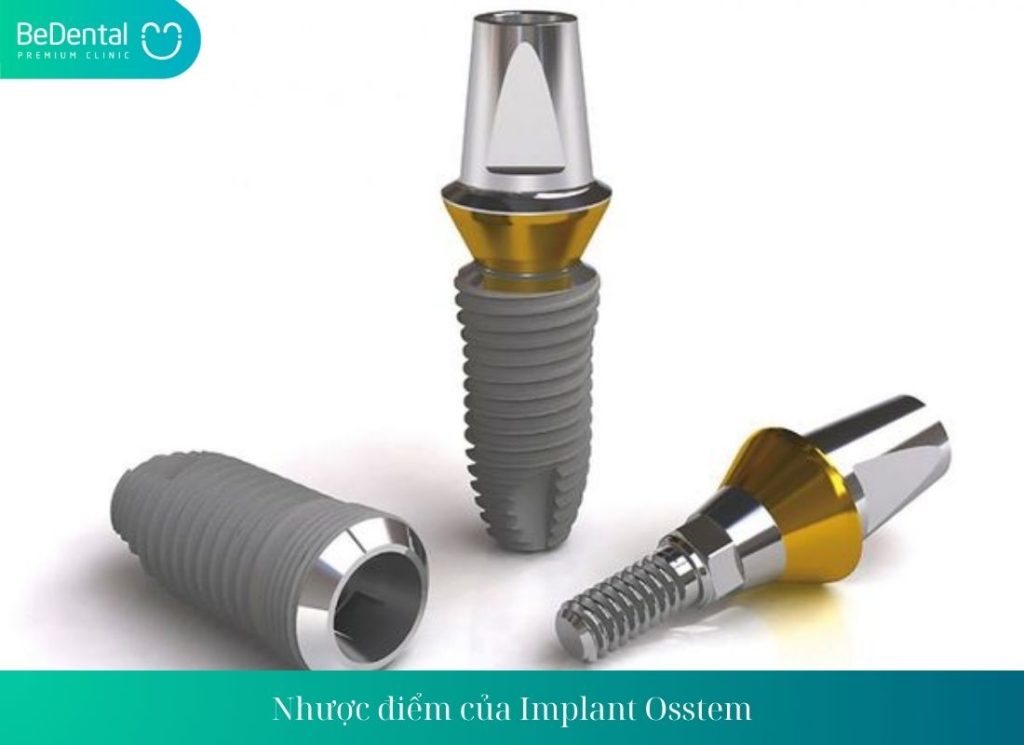 Trồng răng Implant Osstem có hiệu quả không?