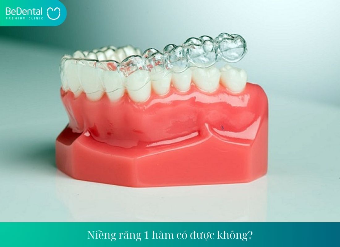 Tác hại của niềng răng trong suốt giá rẻ, Niềng răng móm và 1 vài điều cần biết