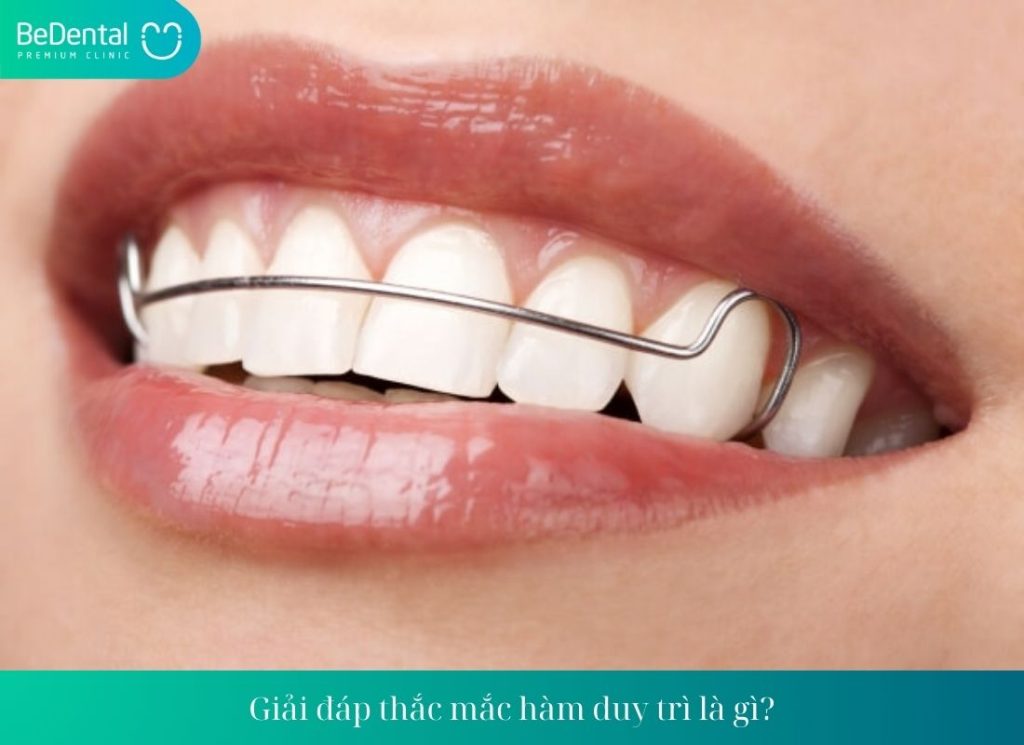 Giải đáp thắc mắc hàm duy trì là gì?