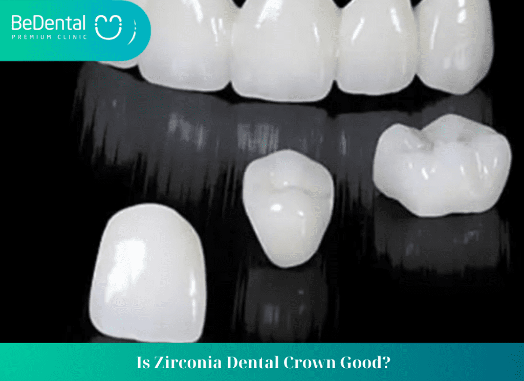 Is Zirconia Dental Crown Good