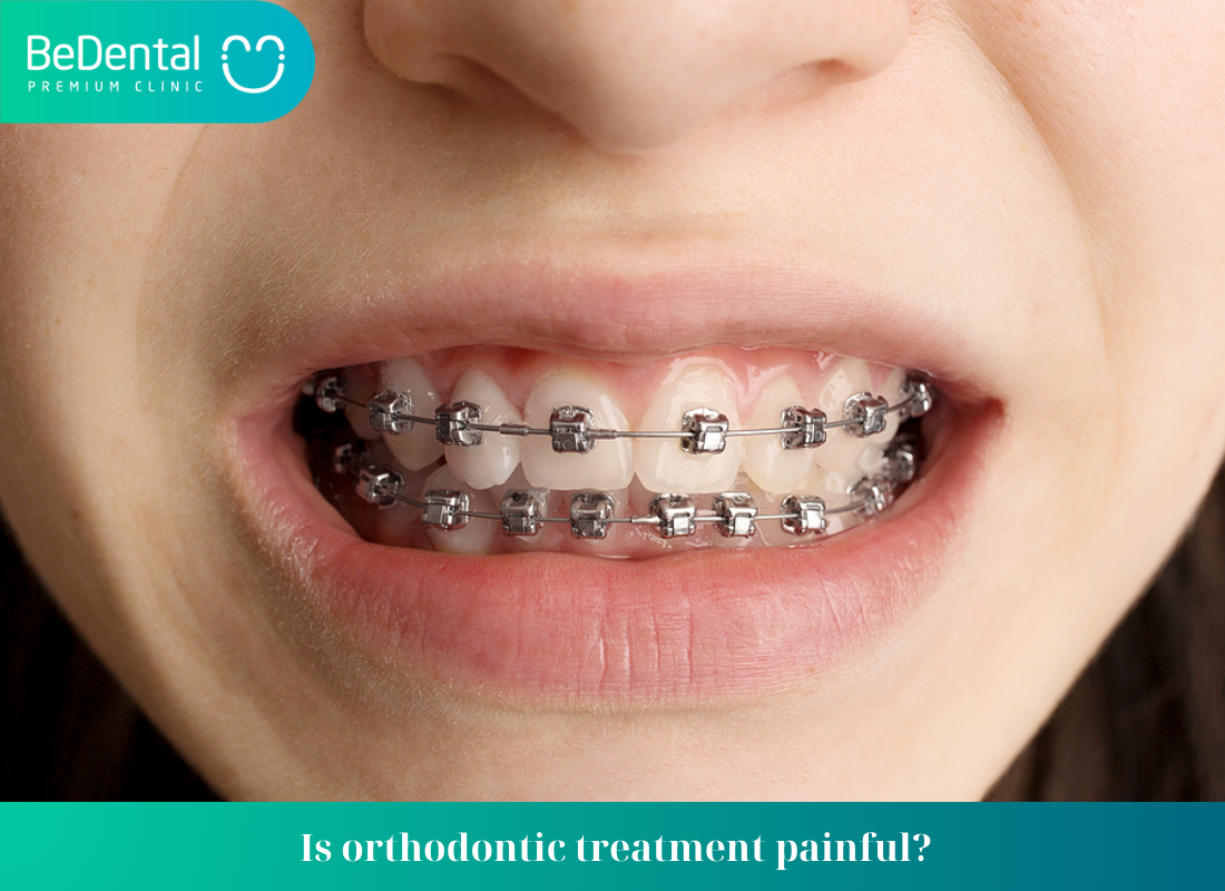 Is orthodontic treatment painful