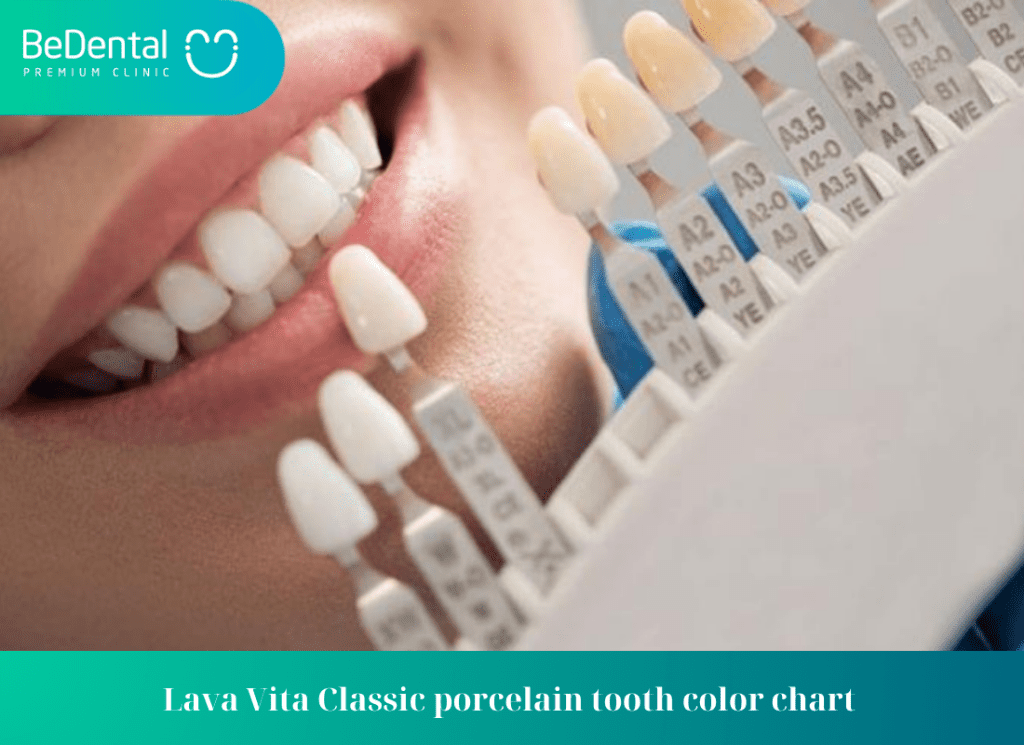 Lava Vita Classic porcelain tooth color chart