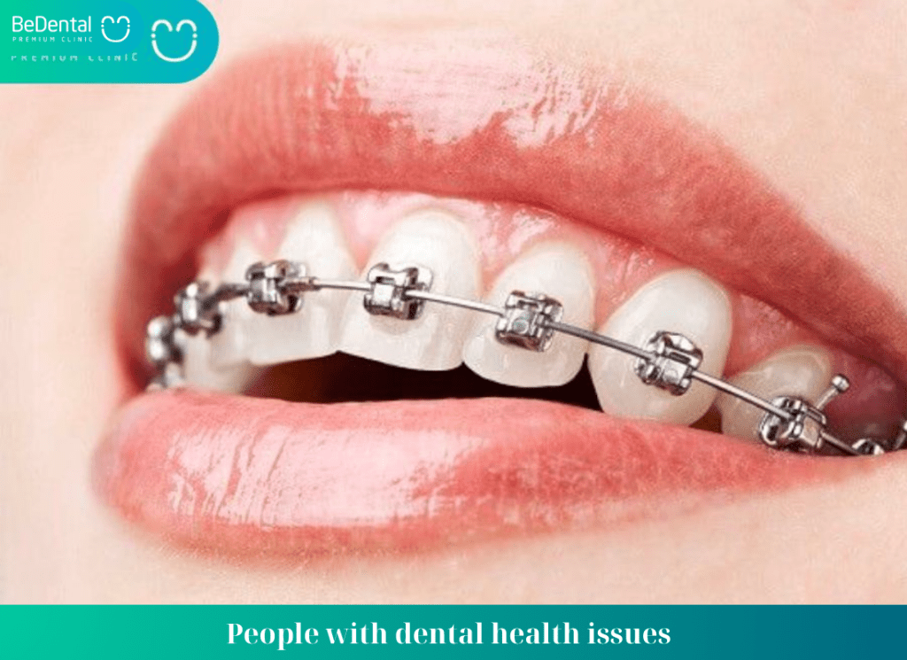 People with dental health issues