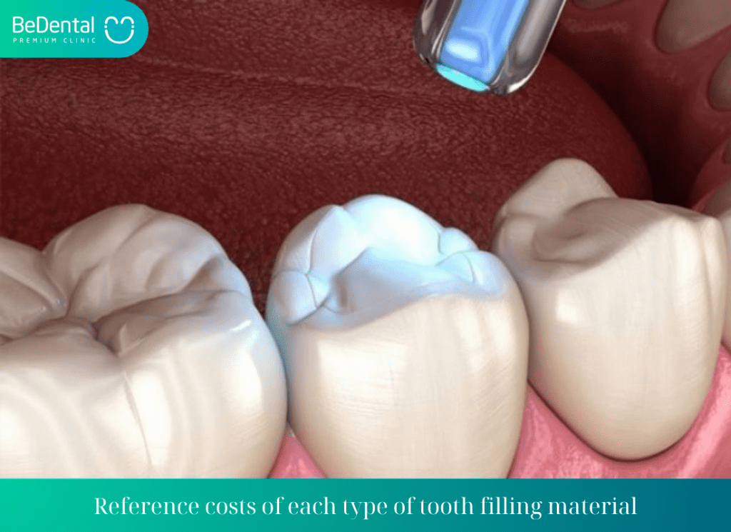 Reference costs of each type of tooth filling material