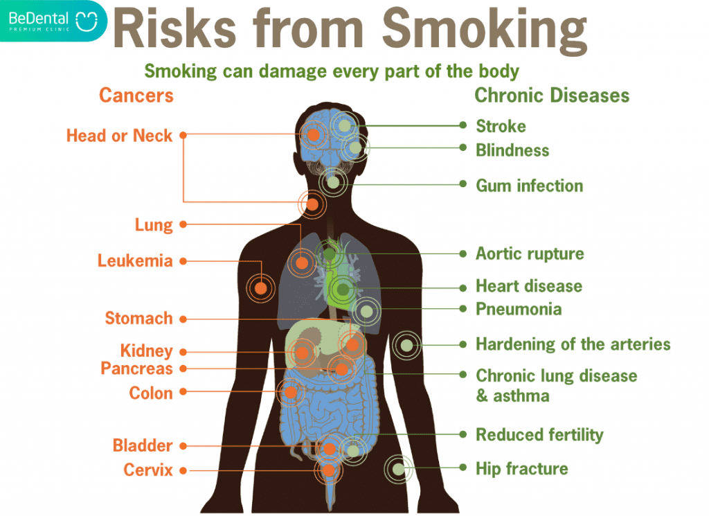 Risks from smoking