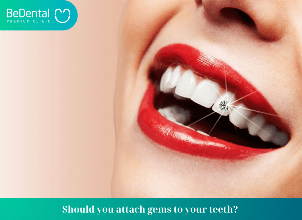 Should you attach gems to your teeth