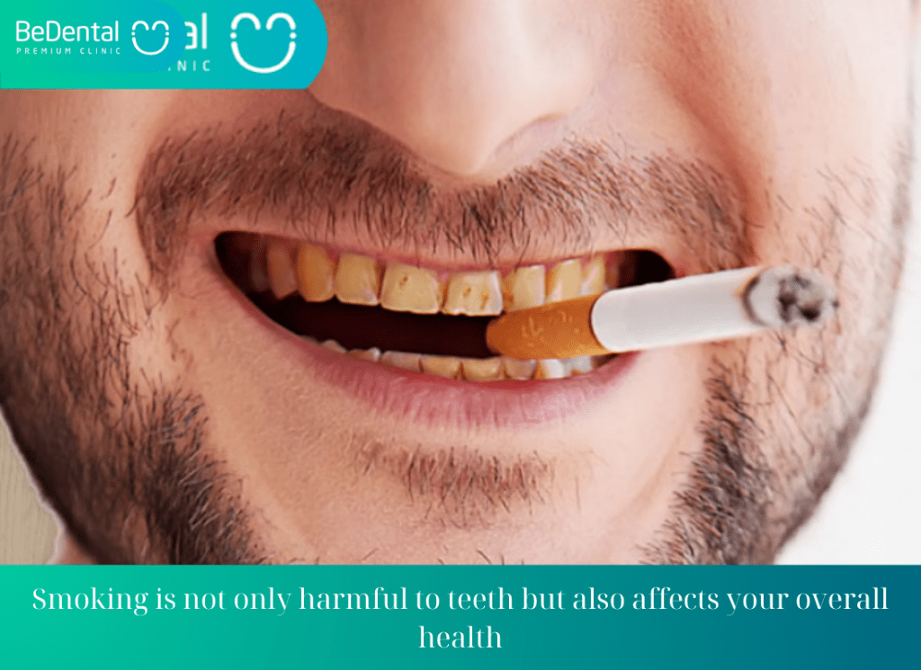 Smoking is not only harmful to teeth but also affects your overall health