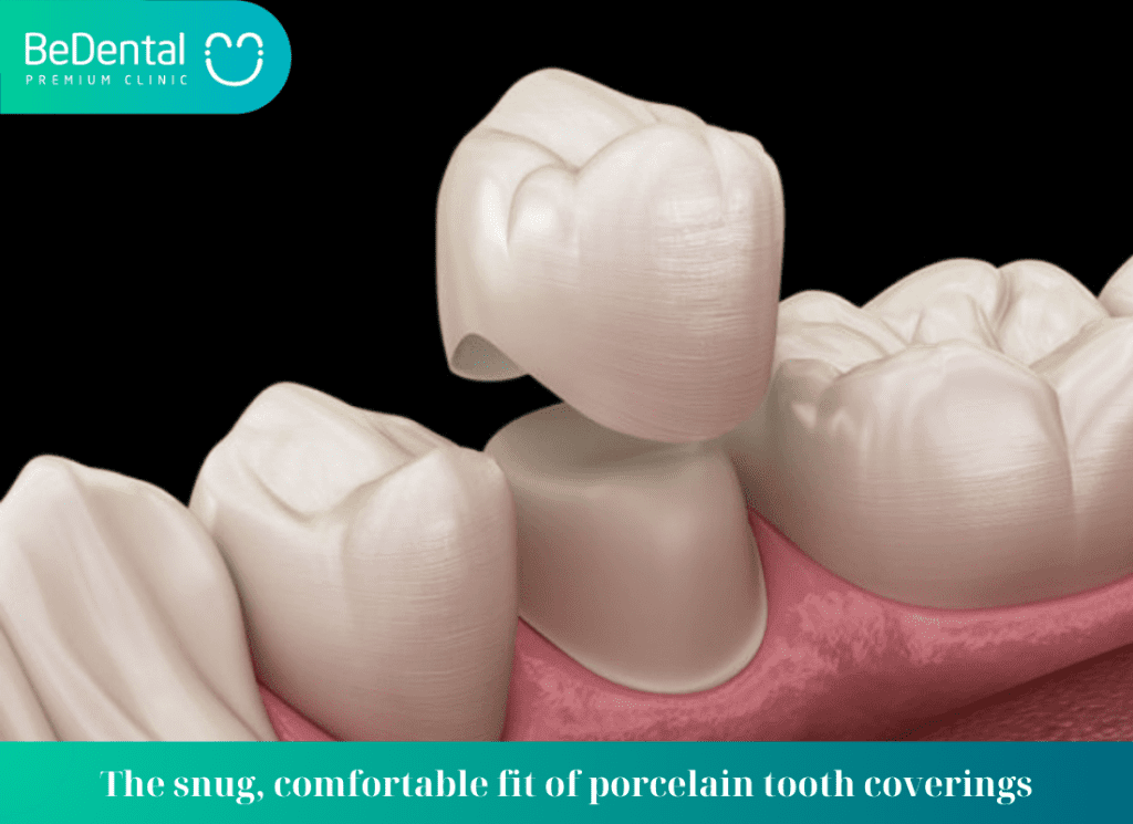 The snug comfortable fit of porcelain tooth coverings