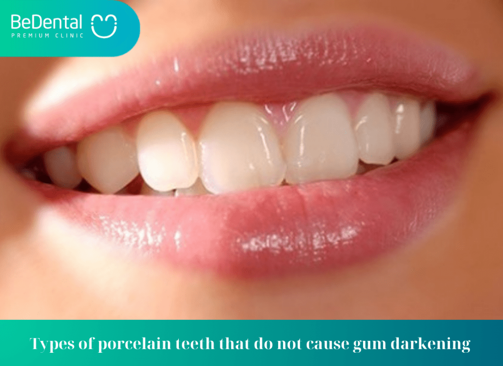 Types of porcelain teeth that do not cause gum darkening