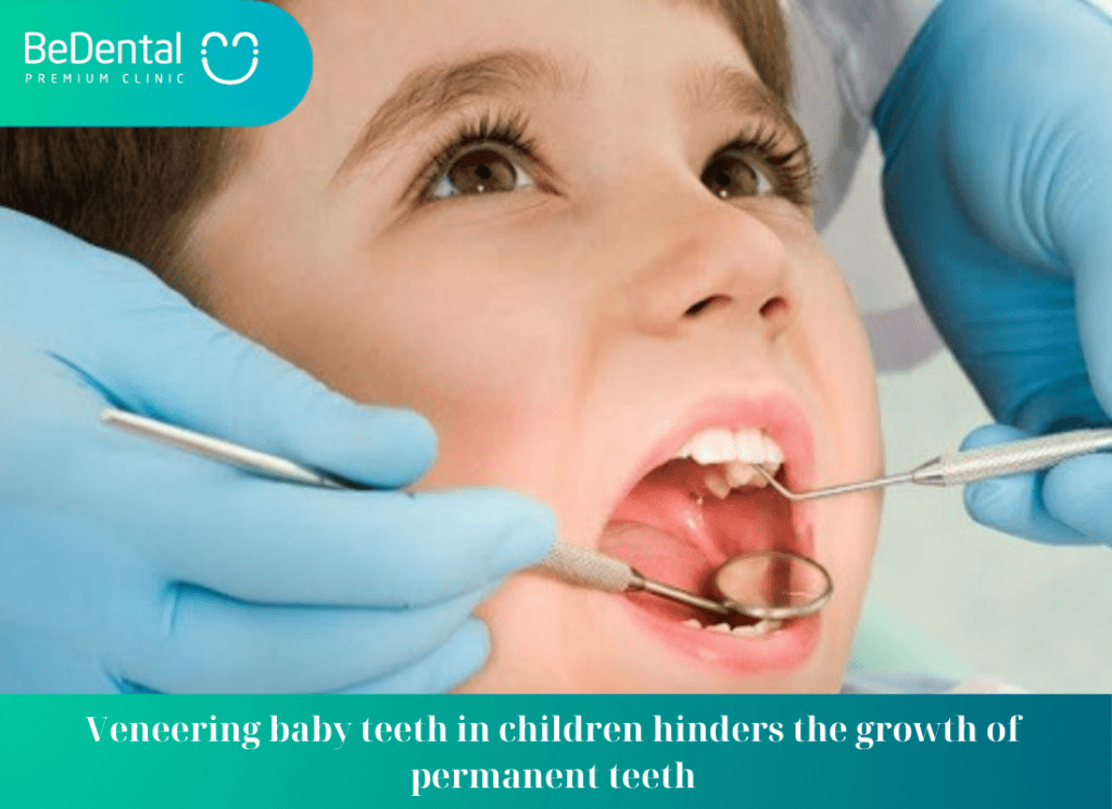 Veneering baby teeth in children hinders the growth of permanent teeth