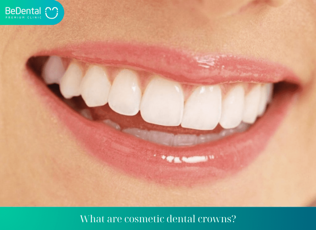 What are cosmetic dental crowns