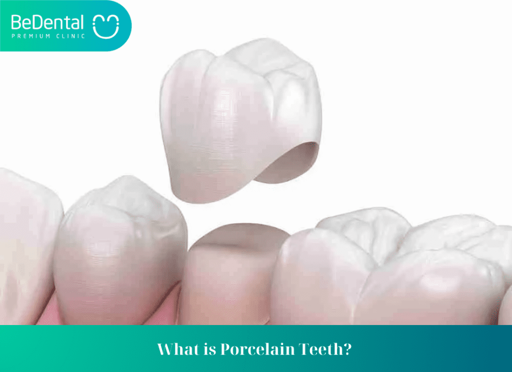 Should children get porcelain teeth