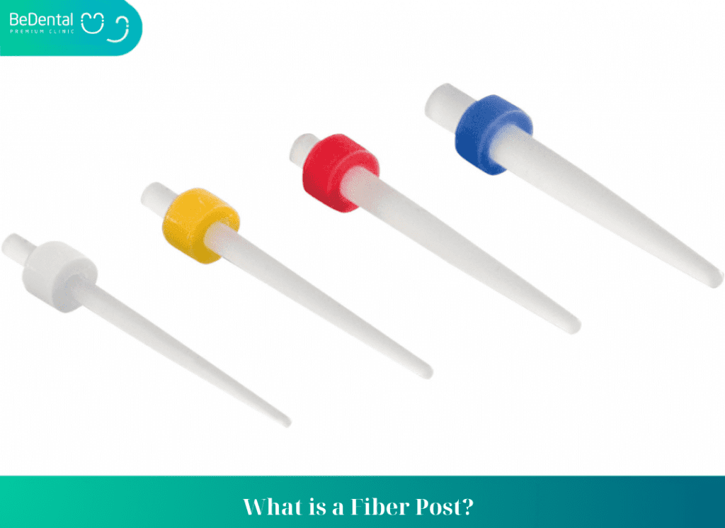 What is a Fiber Post