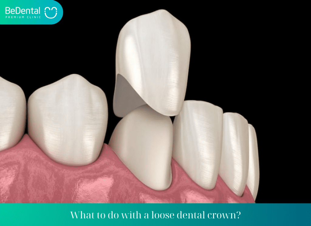 What to do with a loose dental crown