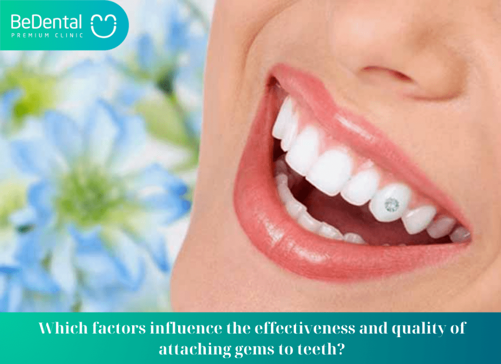 Which factors influence the effectiveness and quality of attaching gems to teeth