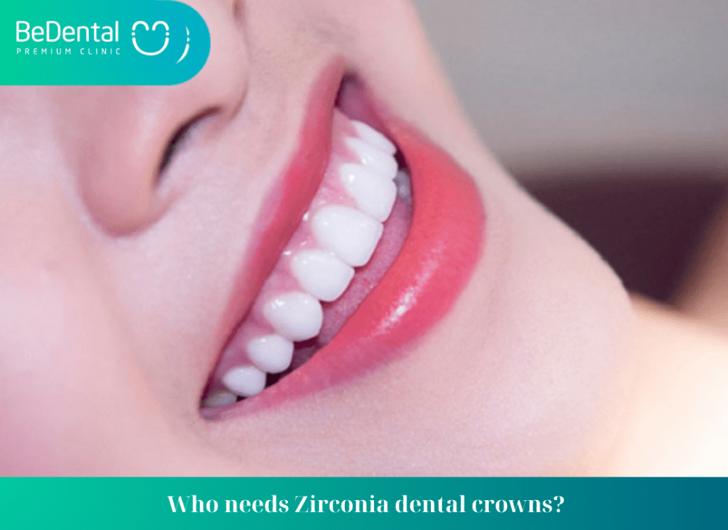 Who needs Zirconia dental crowns