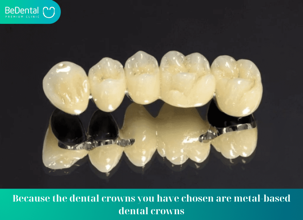 Because the dental crowns you have chosen are metal based dental crowns