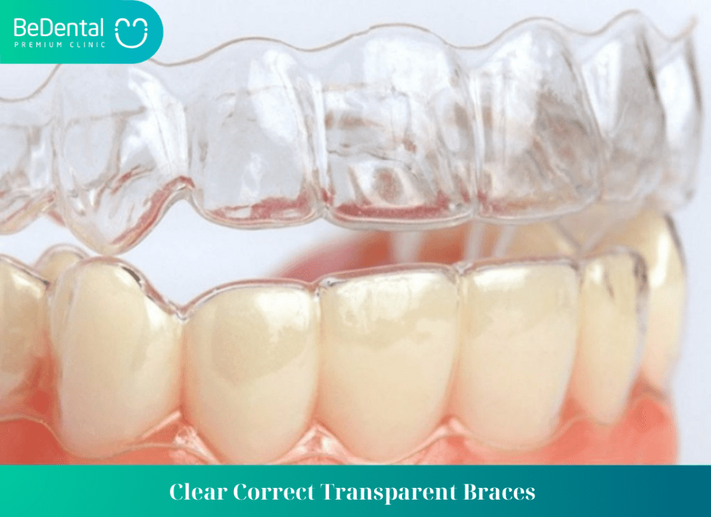 Clear Correct Transparent Braces