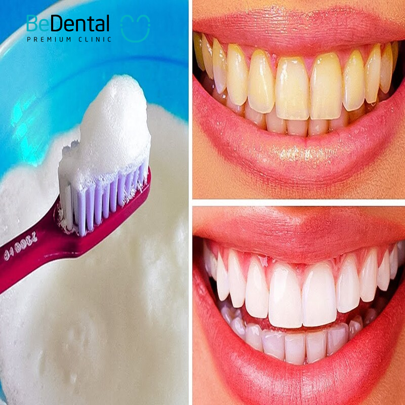 Effective and Safe At Home Teeth Whitening Methods 1