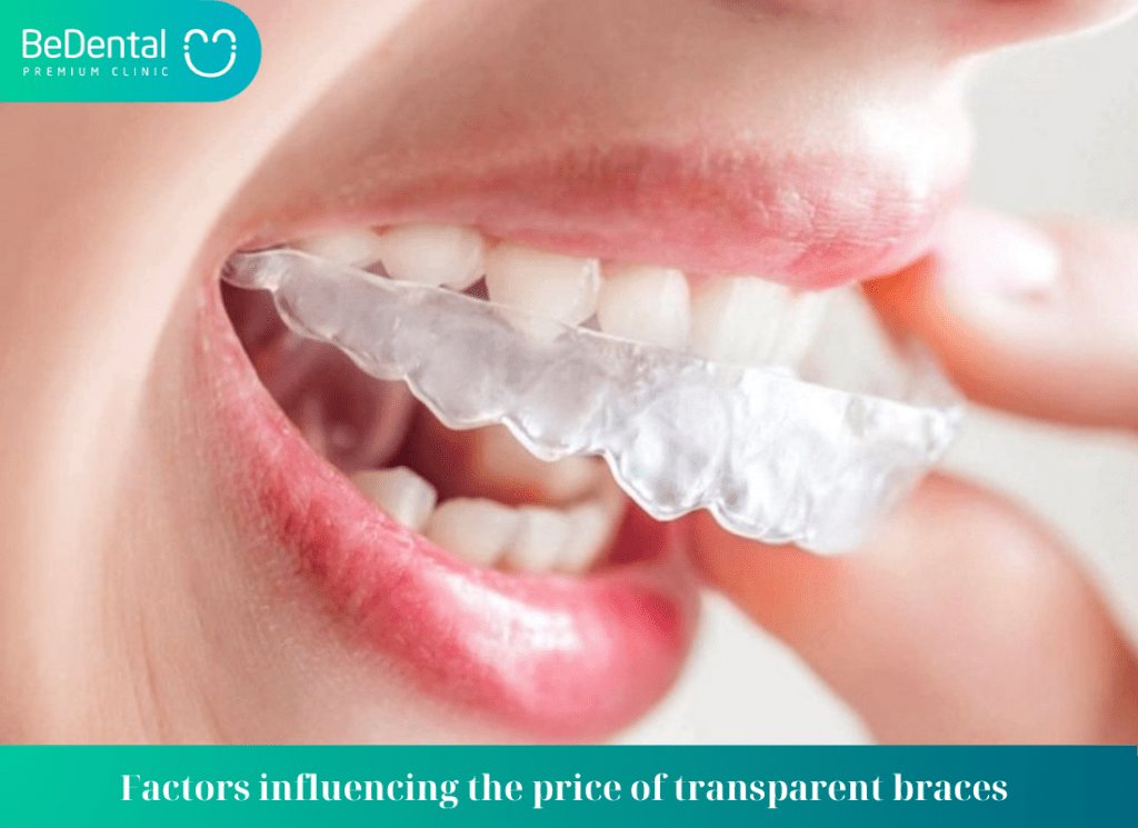 Factors influencing the price of transparent braces