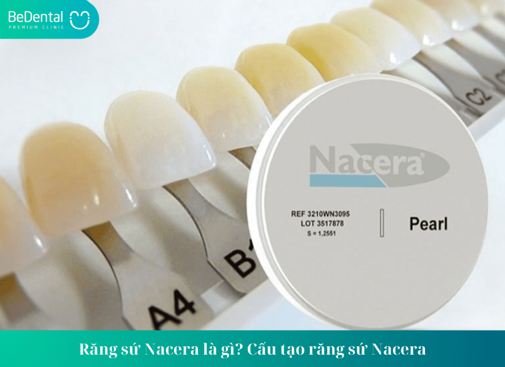 Răng sứ Nacera là gì? Cấu tạo răng sứ Nacera