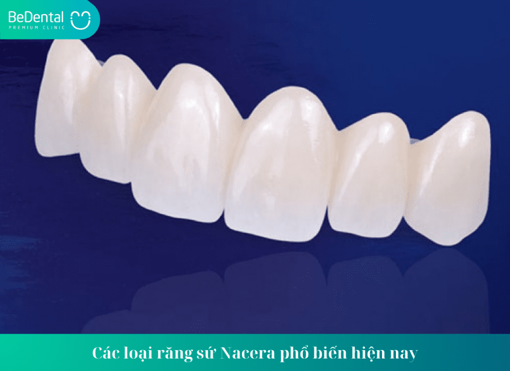 Các loại răng sứ Nacera phổ biến hiện nay