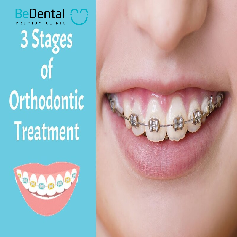 The orthodontic process