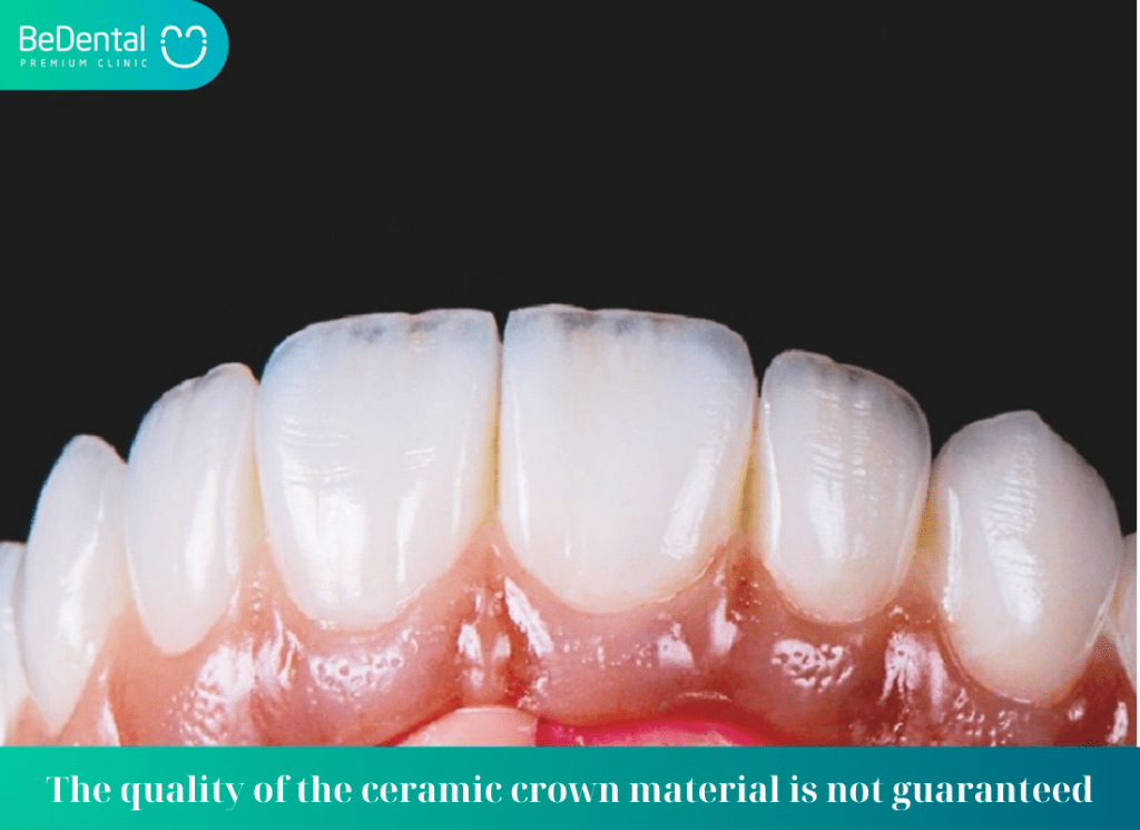 The quality of the ceramic crown material is not guaranteed