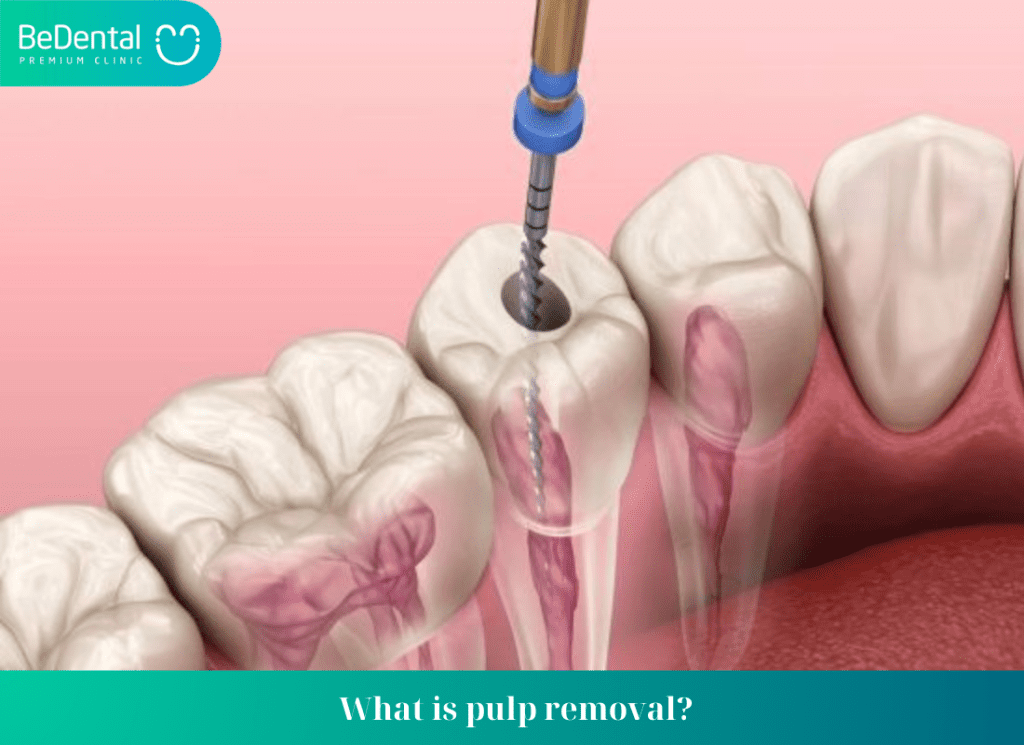 Dental pulp