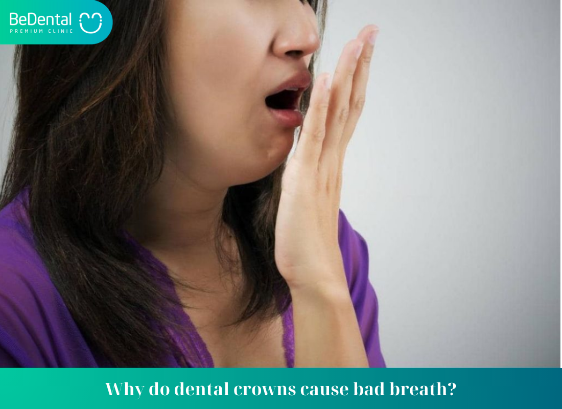 Why do dental crowns cause bad breath