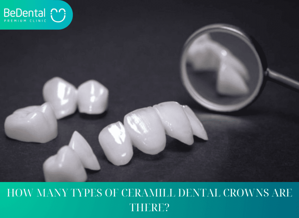 HOW MANY TYPES OF CERAMILL DENTAL CROWNS ARE THERE