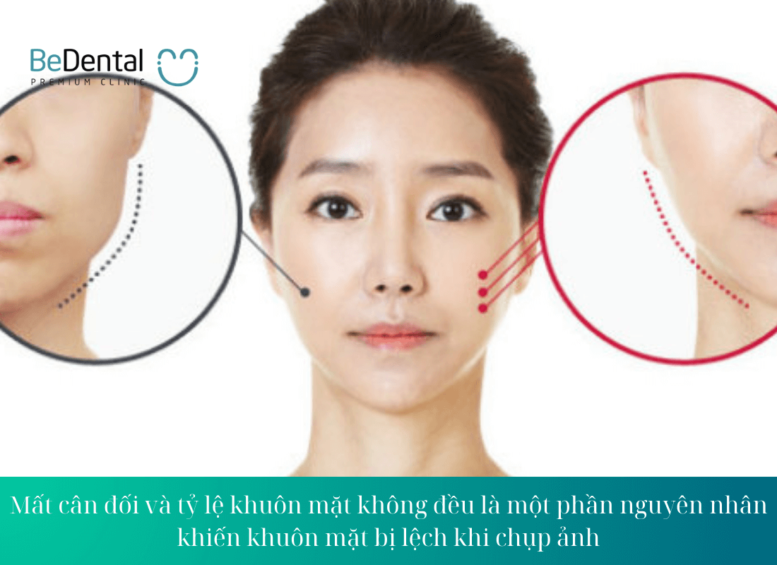 Mất cân đối và tỷ lệ khuôn mặt không đều là một phần nguyên nhân khiến khuôn mặt bị lệch khi chụp ảnh