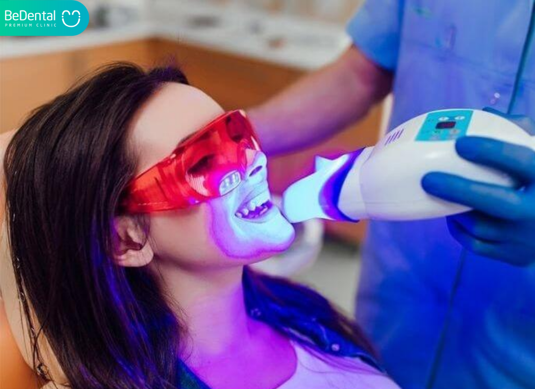 Cong nghe tay trang rang