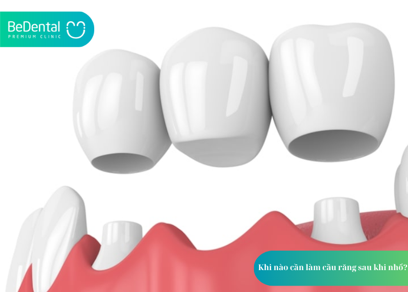 How much does teeth whitening cost 1 3