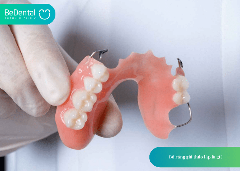 Bộ răng giả: Giải pháp phục hình linh hoạt và tiết kiệm cho người mất răng 2 Bộ răng giả tháo lắp