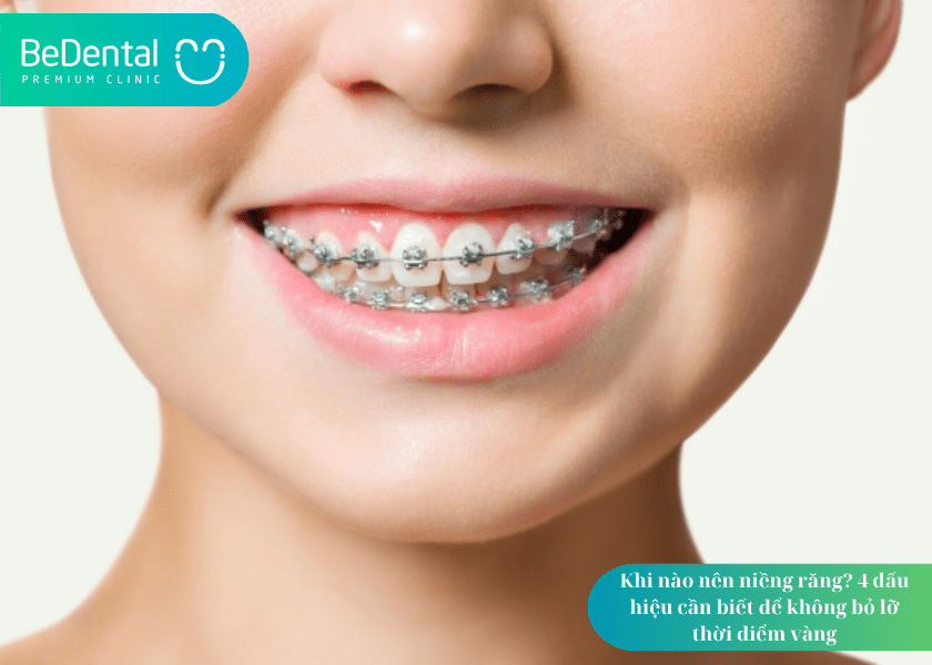 How much does teeth whitening cost 1 min 2