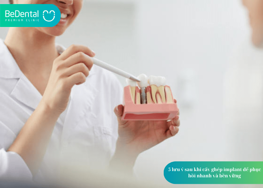 How much does teeth whitening cost 1 min 23