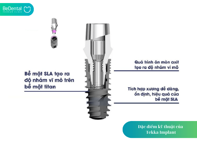 Đặc điểm kỹ thuật của Tekka Implant