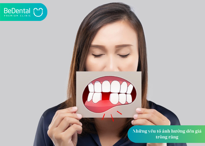 Trồng răng giá bao nhiêu? Cập nhật chi phí, bảng giá và 5 yếu tố quyết định 4 How much does teeth whitening cost 1