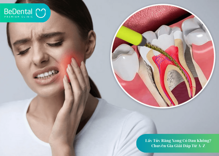Lấy tủy răng xong có đau không?